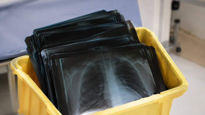 Radiographies empilees dans conteneur medical specialise jaune